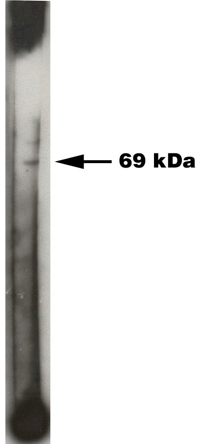 "
Western blot analysis using Sphingosine Kinase 2 antibody on 50 ng  of recombinant Sphinogsine Kinase 2 enzyme (Cat. No. X1709E).  Antibody used at 1:200 dilution.  Visualized using Pierce West Femto substrate system.  Secondary used at 1:30k dilution.  Exposure for 45 seconds."